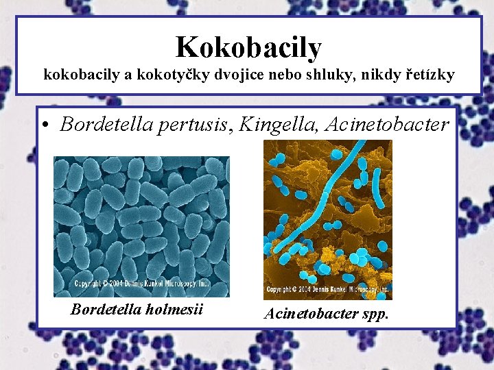 Kokobacily kokobacily a kokotyčky dvojice nebo shluky, nikdy řetízky • Bordetella pertusis, Kingella, Acinetobacter