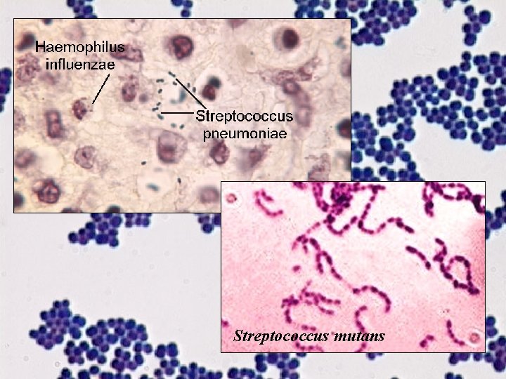 Streptococcus mutans 