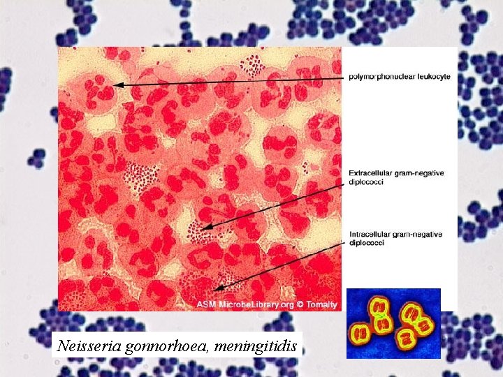 Neisseria gonnorhoea, meningitidis 