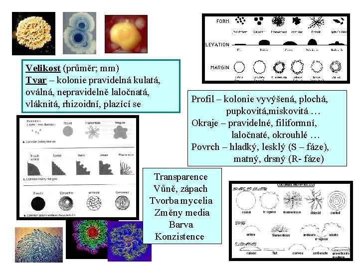 Velikost (průměr; mm) Tvar – kolonie pravidelná kulatá, oválná, nepravidelně laločnatá, vláknitá, rhizoidní, plazící