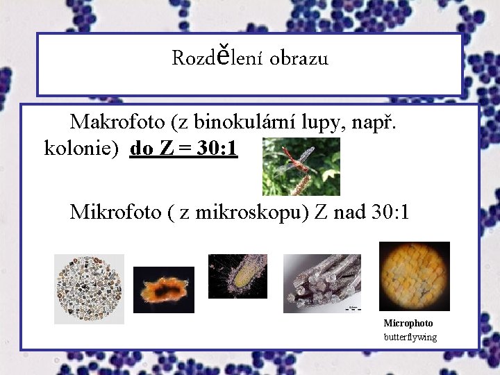 Rozdělení obrazu Makrofoto (z binokulární lupy, např. kolonie) do Z = 30: 1 Mikrofoto