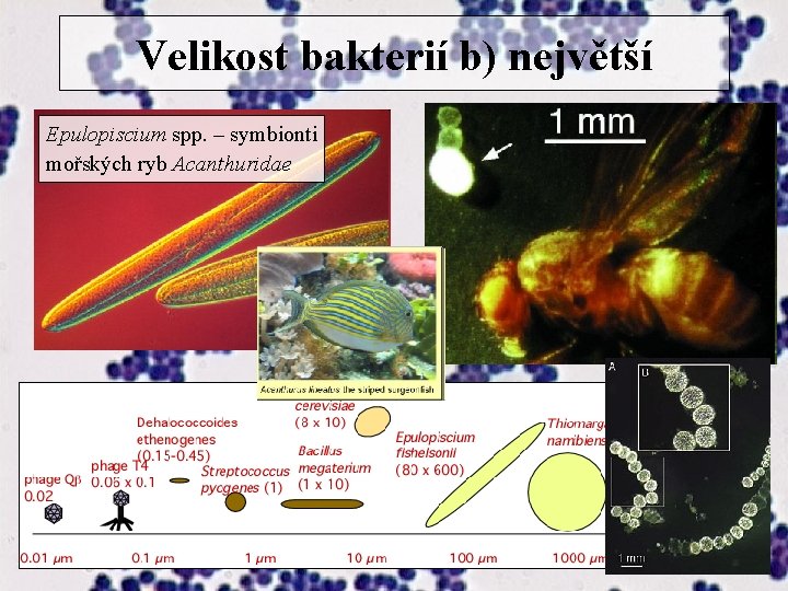 Velikost bakterií b) největší Epulopiscium spp. – symbionti mořských ryb Acanthuridae 