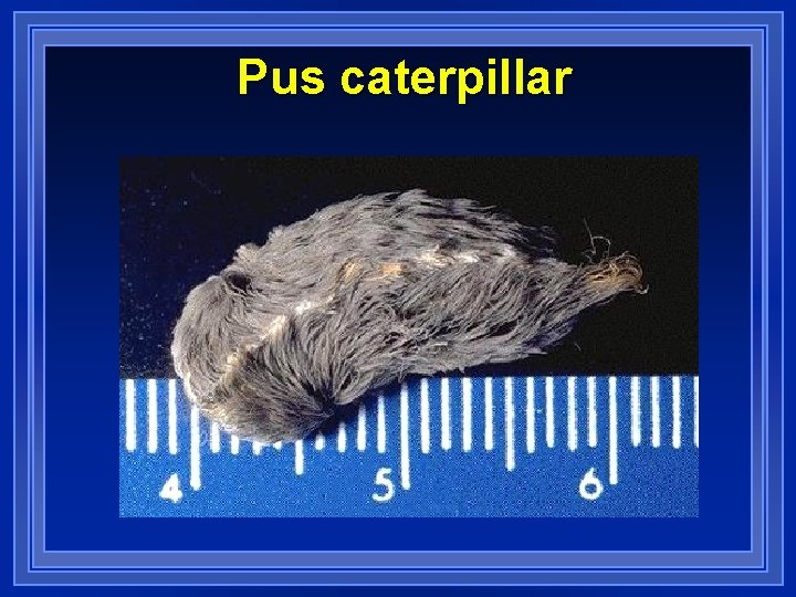Pus caterpillar 