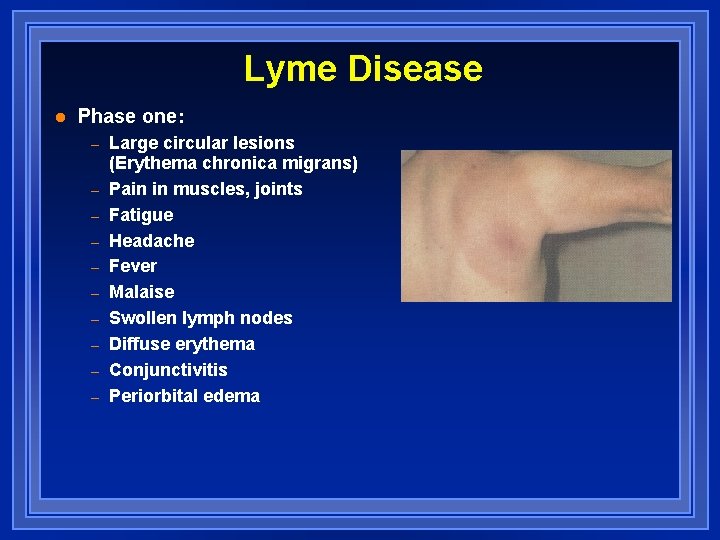 Lyme Disease l Phase one: – – – – – Large circular lesions (Erythema