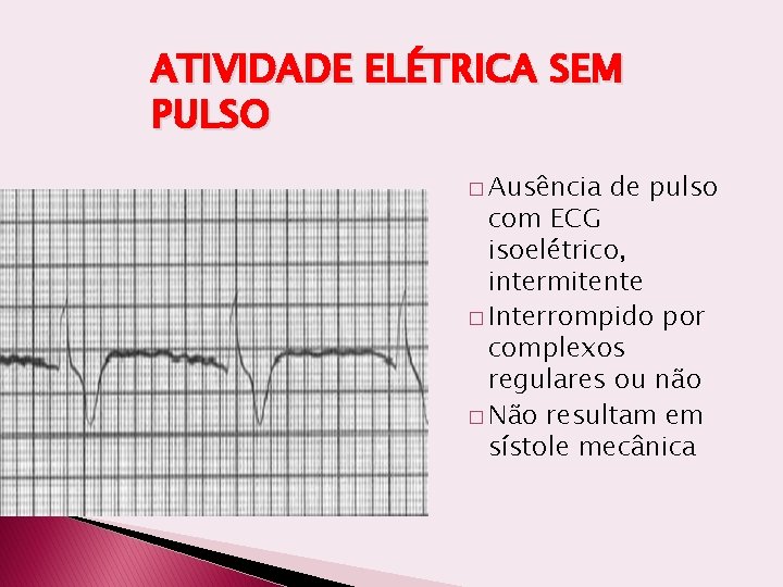 ATIVIDADE ELÉTRICA SEM PULSO � Ausência de pulso com ECG isoelétrico, intermitente � Interrompido