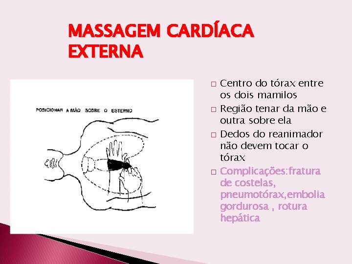 MASSAGEM CARDÍACA EXTERNA � � Centro do tórax entre os dois mamilos Região tenar