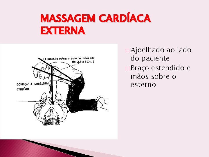 MASSAGEM CARDÍACA EXTERNA � Ajoelhado ao lado do paciente � Braço estendido e mãos