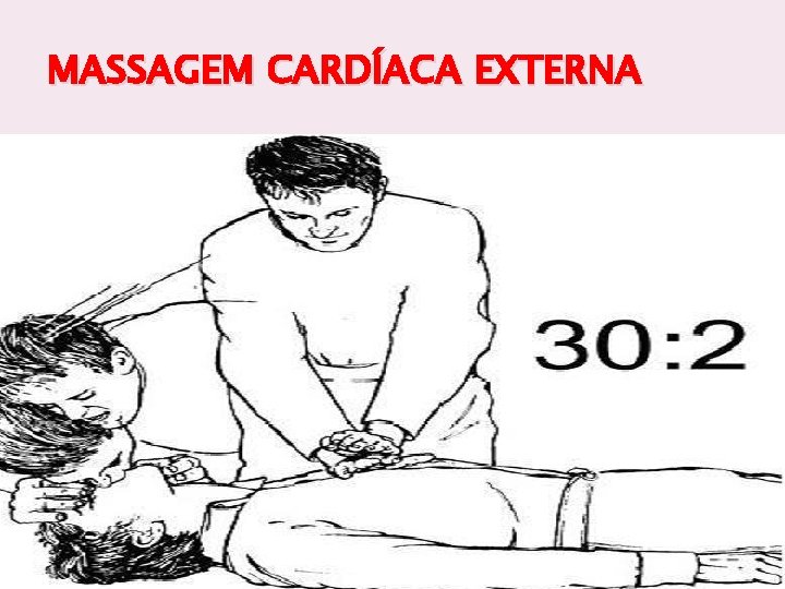 MASSAGEM CARDÍACA EXTERNA 