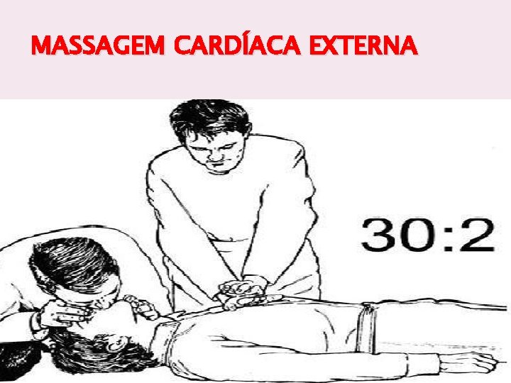 MASSAGEM CARDÍACA EXTERNA 