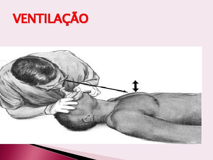 VENTILAÇÃO 