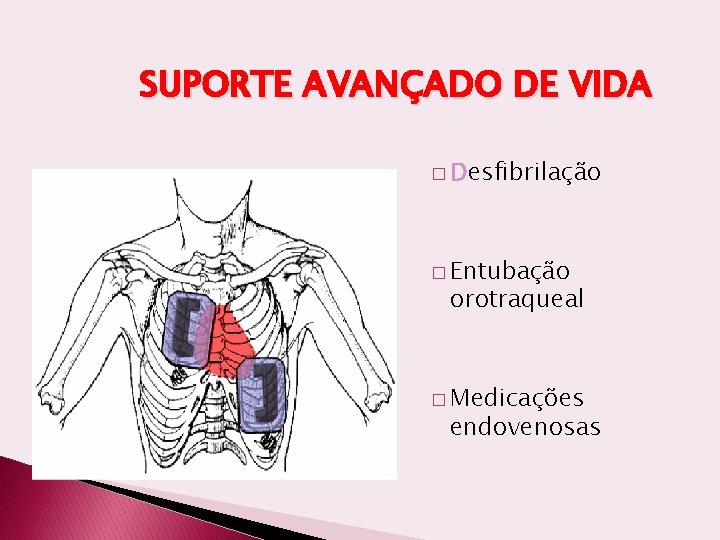 SUPORTE AVANÇADO DE VIDA � Desfibrilação � Entubação orotraqueal � Medicações endovenosas 