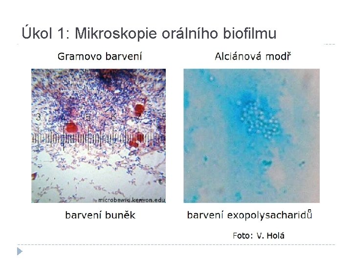 Úkol 1: Mikroskopie orálního biofilmu 