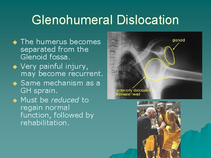 Glenohumeral Dislocation u u The humerus becomes separated from the Glenoid fossa. Very painful