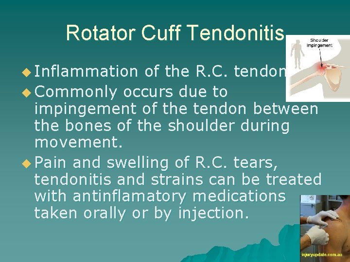 Rotator Cuff Tendonitis u Inflammation of the R. C. tendon. u Commonly occurs due