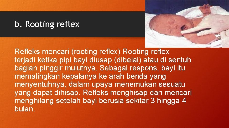 b. Rooting reflex Refleks mencari (rooting reflex) Rooting reflex terjadi ketika pipi bayi diusap