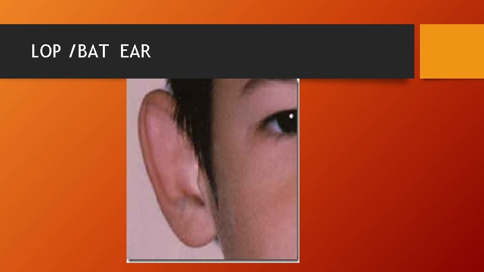 LOP /BAT EAR 