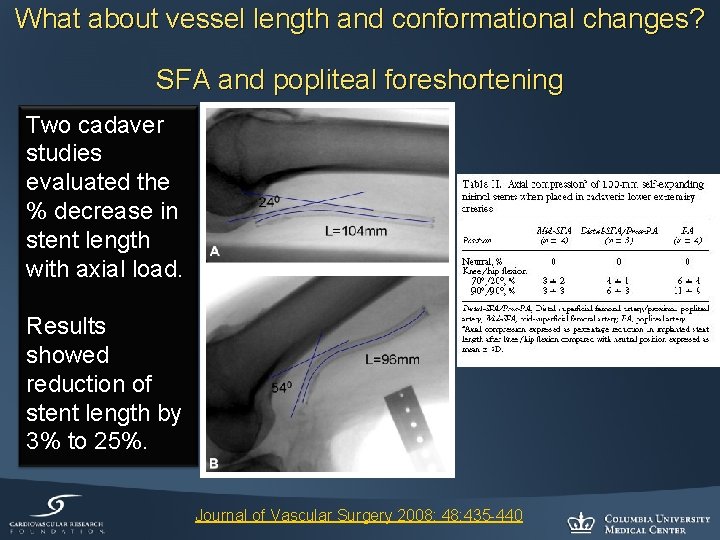 What about vessel length and conformational changes? SFA and popliteal foreshortening Two cadaver studies