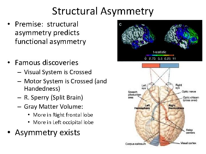 Structural Asymmetry • Premise: structural asymmetry predicts functional asymmetry • Famous discoveries – Visual