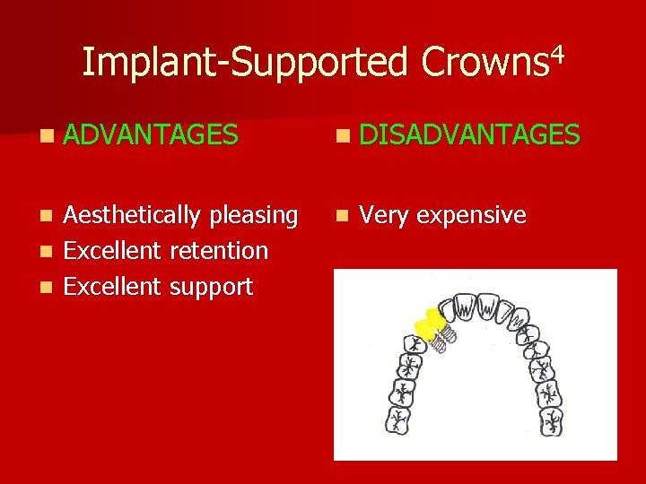 Implant-Supported Crowns 4 n ADVANTAGES n DISADVANTAGES Aesthetically pleasing n Excellent retention n Excellent