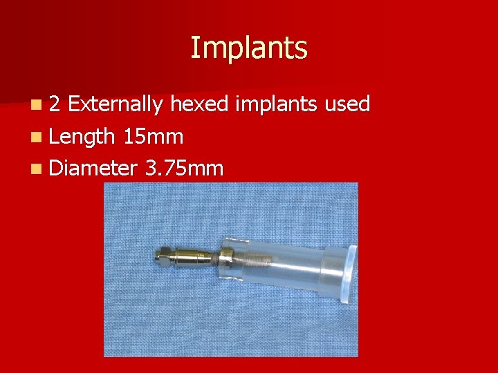 Implants n 2 Externally hexed implants used n Length 15 mm n Diameter 3.