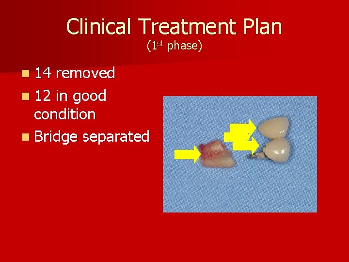 Clinical Treatment Plan (1 st phase) n 14 removed n 12 in good condition