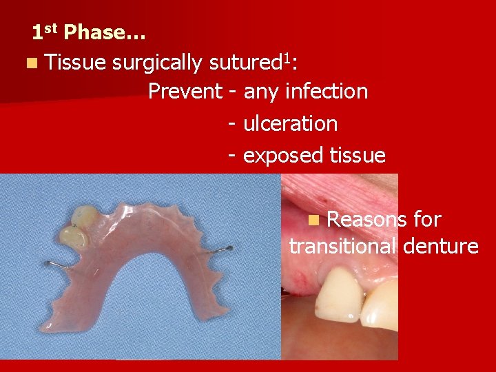 1 st Phase… n Tissue surgically sutured 1: Prevent - any infection - ulceration