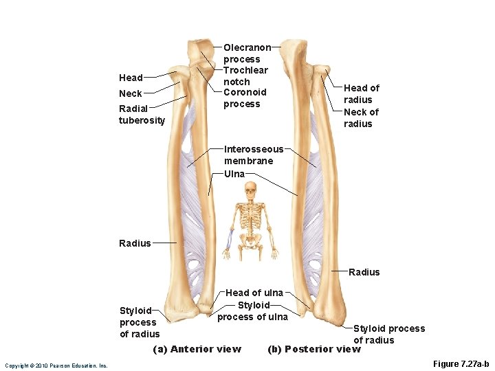 Head Neck Radial tuberosity Olecranon process Trochlear notch Coronoid process Head of radius Neck