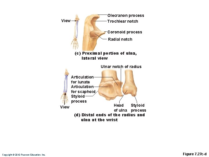 Olecranon process Trochlear notch View Coronoid process Radial notch (c) Proximal portion of ulna,