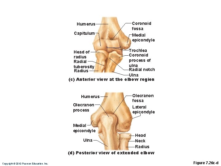 Humerus Capitulum Coronoid fossa Medial epicondyle Trochlea Coronoid process of ulna Radial notch Ulna