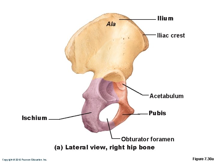 Ala Ilium Iliac crest Acetabulum Ischium Pubis Obturator foramen (a) Lateral view, right hip