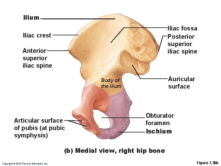 Ilium Iliac fossa Posterior superior iliac spine Iliac crest Anterior superior iliac spine Auricular