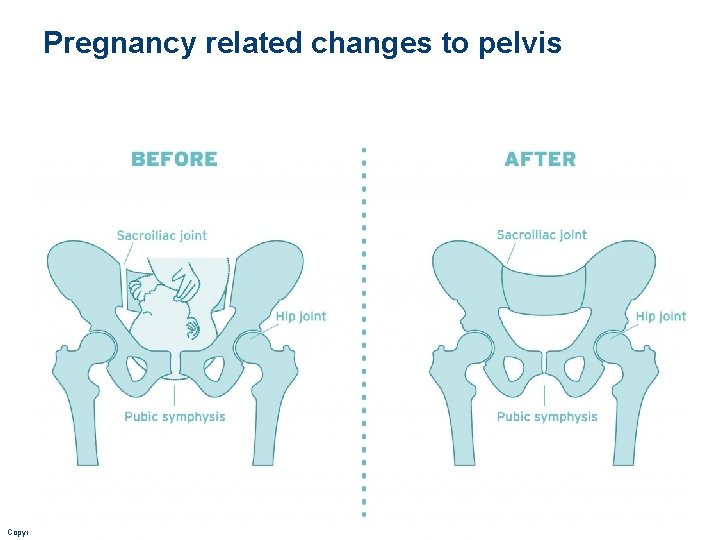 Pregnancy related changes to pelvis Copyright © 2010 Pearson Education, Inc. 