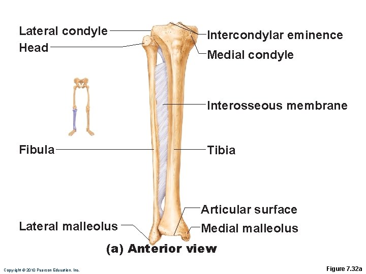 Lateral condyle Head Intercondylar eminence Medial condyle Interosseous membrane Fibula Tibia Articular surface Lateral