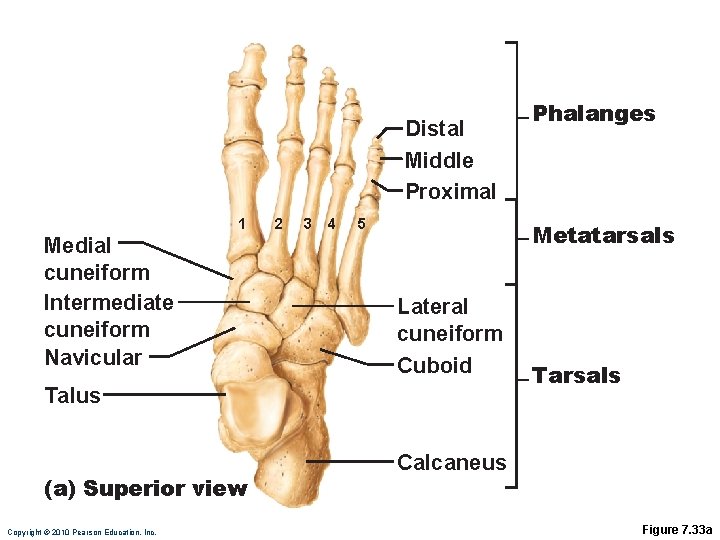 Distal Middle Proximal 1 Medial cuneiform Intermediate cuneiform Navicular 2 3 4 5 Metatarsals