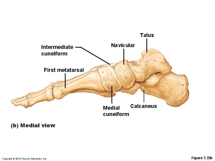 Talus Intermediate cuneiform Navicular First metatarsal Calcaneus Medial cuneiform (b) Medial view Copyright ©