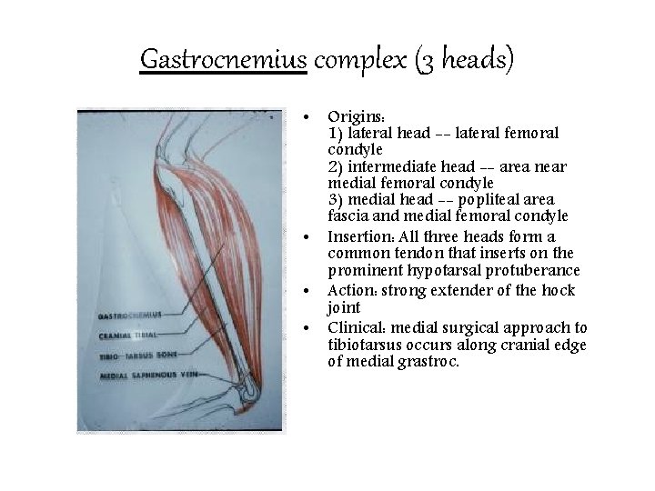 Gastrocnemius complex (3 heads) • • Origins: 1) lateral head -- lateral femoral condyle