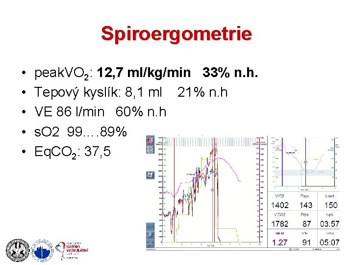 Spiroergometrie • • • peak. VO 2: 12, 7 ml/kg/min 33% n. h. Tepový