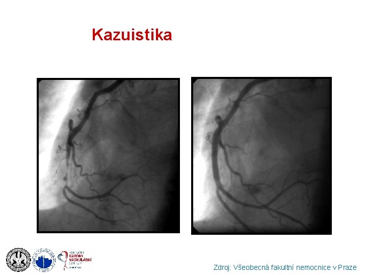 Kazuistika Zdroj: Všeobecná fakultní nemocnice v Praze 