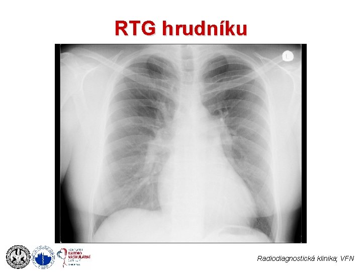 RTG hrudníku Radiodiagnostická klinika; VFN 