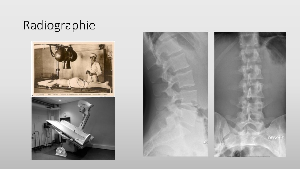 Radiographie 