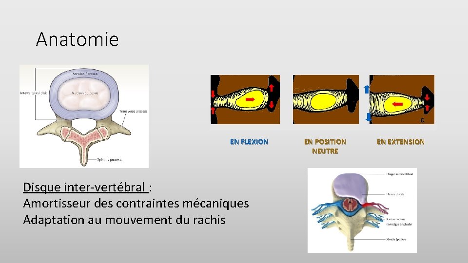 Anatomie EN FLEXION Disque inter-vertébral : Amortisseur des contraintes mécaniques Adaptation au mouvement du