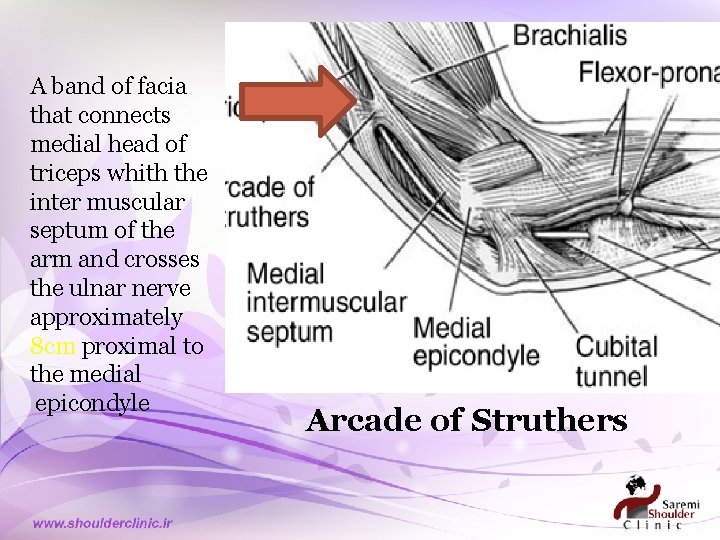 A band of facia that connects medial head of triceps whith the inter muscular