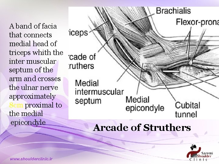 A band of facia that connects medial head of triceps whith the inter muscular