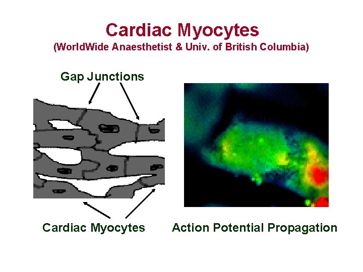 Cardiac Myocytes (World. Wide Anaesthetist & Univ. of British Columbia) Gap Junctions Cardiac Myocytes