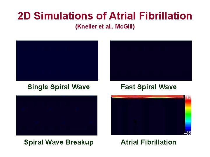 2 D Simulations of Atrial Fibrillation (Kneller et al. , Mc. Gill) Single Spiral