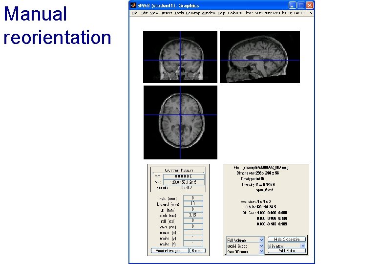 Manual reorientation 