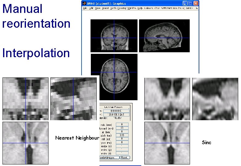 Manual reorientation Interpolation Nearest Neighbour (Bi)linear Sinc 