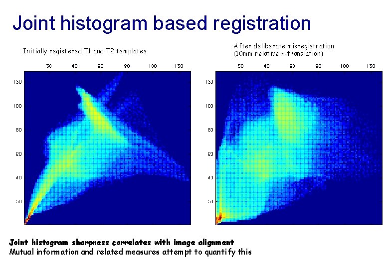 Joint histogram based registration Initially registered T 1 and T 2 templates After deliberate