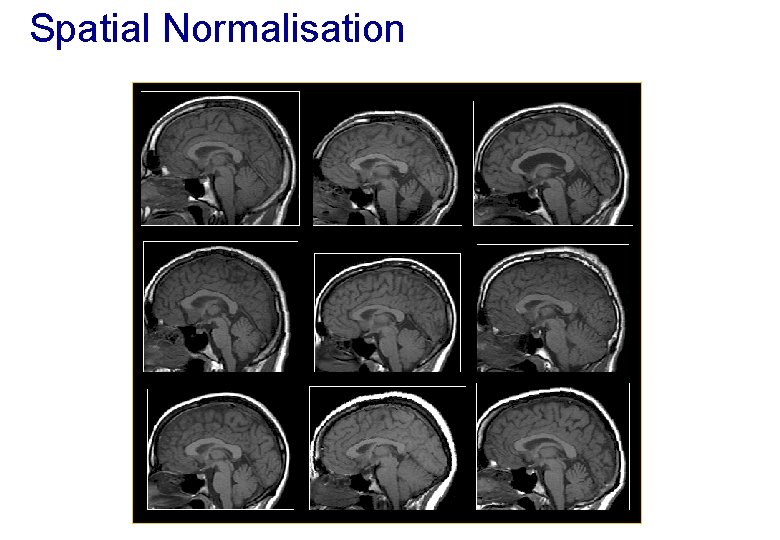 Spatial Normalisation 