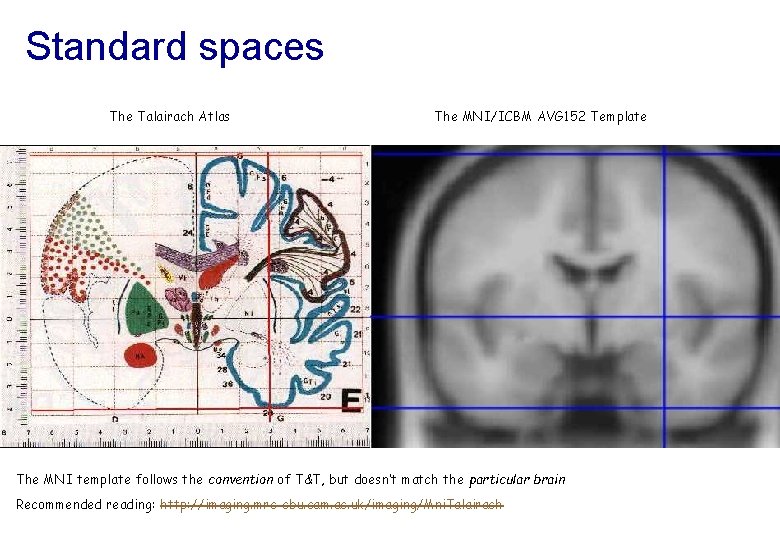 Standard spaces The Talairach Atlas The MNI/ICBM AVG 152 Template The MNI template follows